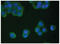 TIMP Metallopeptidase Inhibitor 4 antibody, 99-775, ProSci, Enzyme Linked Immunosorbent Assay image 