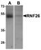 Ring Finger Protein 26 antibody, A15996, Boster Biological Technology, Western Blot image 