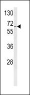 Cytochrome P450 Family 4 Subfamily F Member 3 antibody, LS-C167241, Lifespan Biosciences, Western Blot image 