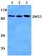 Zinc Finger Protein 25 antibody, A14228, Boster Biological Technology, Western Blot image 