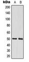 Cleavage Stimulation Factor Subunit 1 antibody, orb216078, Biorbyt, Western Blot image 