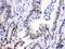 Cyclin Dependent Kinase 9 antibody, PB9537, Boster Biological Technology, Immunohistochemistry paraffin image 