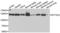 Elongation Factor Tu GTP Binding Domain Containing 2 antibody, LS-C346198, Lifespan Biosciences, Western Blot image 