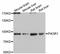 Phosphoinositide-3-Kinase Regulatory Subunit 1 antibody, A11402, ABclonal Technology, Western Blot image 