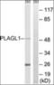 PLAG1 Like Zinc Finger 1 antibody, orb313922, Biorbyt, Western Blot image 