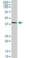 Sphingosine Kinase 1 antibody, H00008877-M01, Novus Biologicals, Western Blot image 