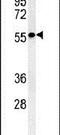 Serine/Threonine Kinase 33 antibody, PA5-14739, Invitrogen Antibodies, Western Blot image 