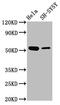 Mex-3 RNA Binding Family Member A antibody, CSB-PA013740LA01HU, Cusabio, Western Blot image 