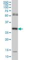 N-Methylpurine DNA Glycosylase antibody, H00004350-M06, Novus Biologicals, Western Blot image 