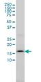 Signal Sequence Receptor Subunit 4 antibody, H00006748-M01, Novus Biologicals, Western Blot image 