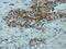 Matrix Metallopeptidase 1 antibody, LS-C331338, Lifespan Biosciences, Immunohistochemistry frozen image 