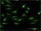 Protein Kinase C Delta antibody, H00005580-M09, Novus Biologicals, Immunofluorescence image 