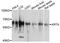 Keratin 9 antibody, abx136029, Abbexa, Western Blot image 