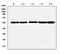Matrix Metallopeptidase 1 antibody, A00733-1, Boster Biological Technology, Western Blot image 
