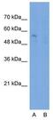 Solute carrier family 22 member 7 antibody, GTX47049, GeneTex, Western Blot image 