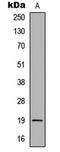 TNF Receptor Superfamily Member 13C antibody, LS-C354320, Lifespan Biosciences, Western Blot image 