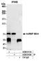 Heterogeneous Nuclear Ribonucleoprotein M antibody, A500-011A, Bethyl Labs, Immunoprecipitation image 