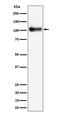 Thrombomodulin antibody, M01325-2, Boster Biological Technology, Western Blot image 