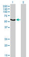 FGR Proto-Oncogene, Src Family Tyrosine Kinase antibody, LS-C133193, Lifespan Biosciences, Western Blot image 