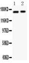 Glutamate Ionotropic Receptor NMDA Type Subunit 2A antibody, PA1058-1, Boster Biological Technology, Western Blot image 