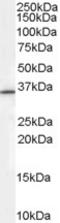 Ring Finger Protein 115 antibody, NB100-41373, Novus Biologicals, Western Blot image 