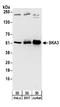 Spindle and kinetochore-associated protein 3 antibody, A304-215A, Bethyl Labs, Western Blot image 