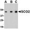 SCO Cytochrome C Oxidase Assembly Protein 2 antibody, orb74804, Biorbyt, Western Blot image 