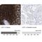 Lymphocyte Cytosolic Protein 1 antibody, NBP1-88057, Novus Biologicals, Immunohistochemistry paraffin image 