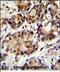 PELP1 antibody, PA5-48299, Invitrogen Antibodies, Immunohistochemistry paraffin image 