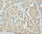 Palmitoyl-protein thioesterase 1 antibody, M02690, Boster Biological Technology, Immunohistochemistry paraffin image 