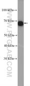 EH Domain Containing 4 antibody, 11382-2-AP, Proteintech Group, Western Blot image 