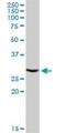 ATPase H+ Transporting V1 Subunit E1 antibody, H00000529-D01P, Novus Biologicals, Western Blot image 