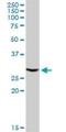 V-type proton ATPase subunit E 1 antibody, H00000529-D01P, Novus Biologicals, Western Blot image 