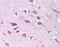 Tolloid Like 2 antibody, NBP1-44188, Novus Biologicals, Immunohistochemistry paraffin image 