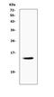 Cystatin A antibody, PB9564, Boster Biological Technology, Western Blot image 
