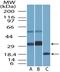 Bone Marrow Stromal Cell Antigen 2 antibody, NBP2-29621, Novus Biologicals, Western Blot image 