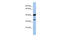 Leucine Rich Repeat Containing 57 antibody, 27-051, ProSci, Western Blot image 
