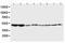 5-Hydroxytryptamine Receptor 2A antibody, PA1373, Boster Biological Technology, Western Blot image 