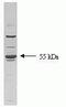 Transforming Growth Factor Beta Receptor 1 antibody, AHO1552, Invitrogen Antibodies, Western Blot image 