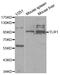 Toll Like Receptor 1 antibody, TA332388, Origene, Western Blot image 