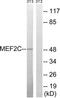 Myocyte Enhancer Factor 2C antibody, TA326189, Origene, Western Blot image 