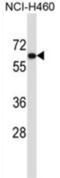 UDP Glucuronosyltransferase Family 2 Member B11 antibody, abx027437, Abbexa, Western Blot image 