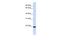 Tight Junction Associated Protein 1 antibody, A12692, Boster Biological Technology, Western Blot image 