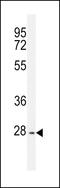 Tyrosine-protein phosphatase non-receptor type 20 antibody, 56-046, ProSci, Western Blot image 