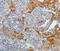 B-Raf Proto-Oncogene, Serine/Threonine Kinase antibody, LS-C332317, Lifespan Biosciences, Immunohistochemistry frozen image 