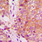 Filamin A antibody, LS-C352201, Lifespan Biosciences, Immunohistochemistry paraffin image 