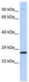 Proteasome Subunit Beta 4 antibody, TA342167, Origene, Western Blot image 
