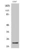 Cerebellin 2 Precursor antibody, STJ92234, St John