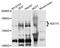 Adenylate Cyclase 3 antibody, STJ110180, St John