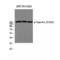 DNA Topoisomerase II Alpha antibody, LS-C381438, Lifespan Biosciences, Western Blot image 